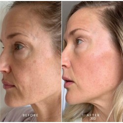 BEE FACTOR Lifting Serum -Χαβιάρι με  Υαλουρονικ΄΄ο & Majestem 30ml