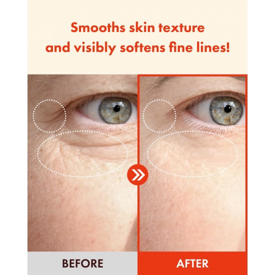 It's Skin RetinoidiN - Eye Cream 25ml It's Skin RetinoidiN - Eye Cream 25ml